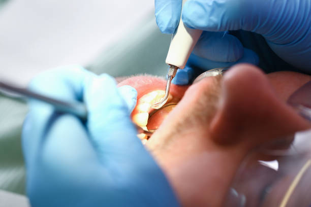 Best Emergency Treatment for Dental Infections or Abscesses in Poynette, WI